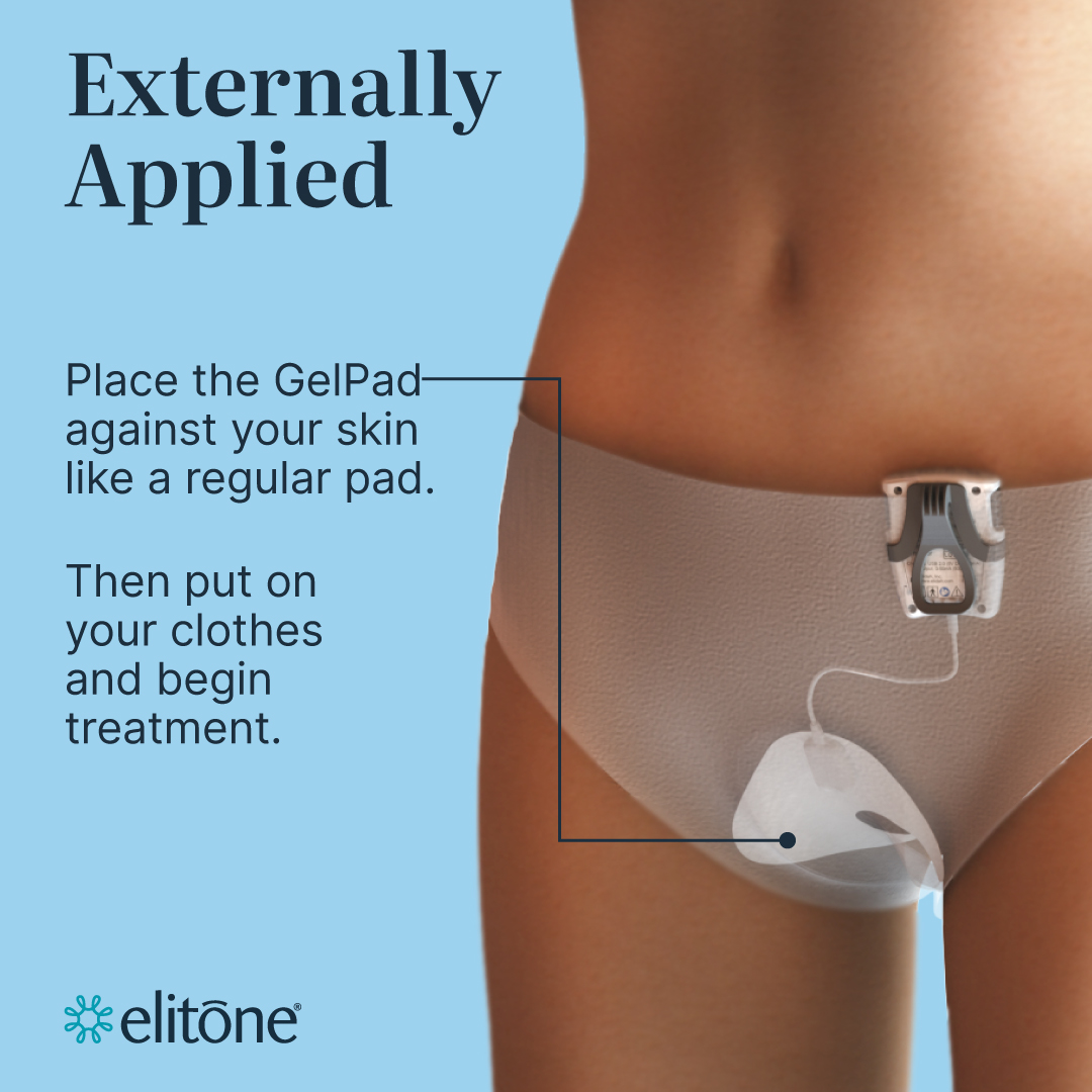 Pelvic floor therapy